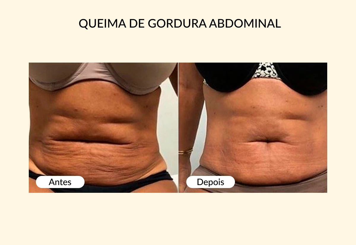 QUEIMA DE GORDURA ABDOMINAL